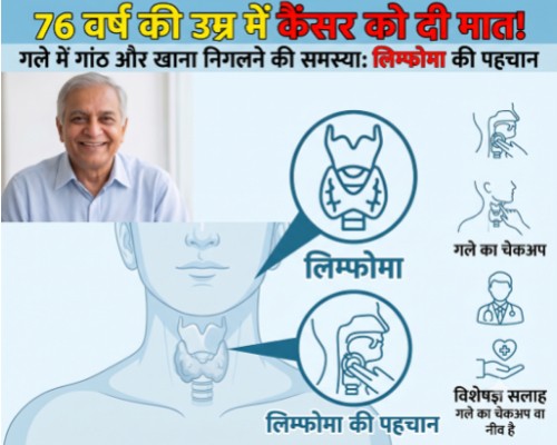 76 वर्ष के बुजुर्ग ने जीती गले के कैंसर (लिम्फोमा) से जंग: जानिए लक्षण, जांच और आयुष्मान भारत योजना से इलाज की कहानी